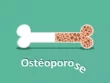 Comment prévenir l’ostéoporose